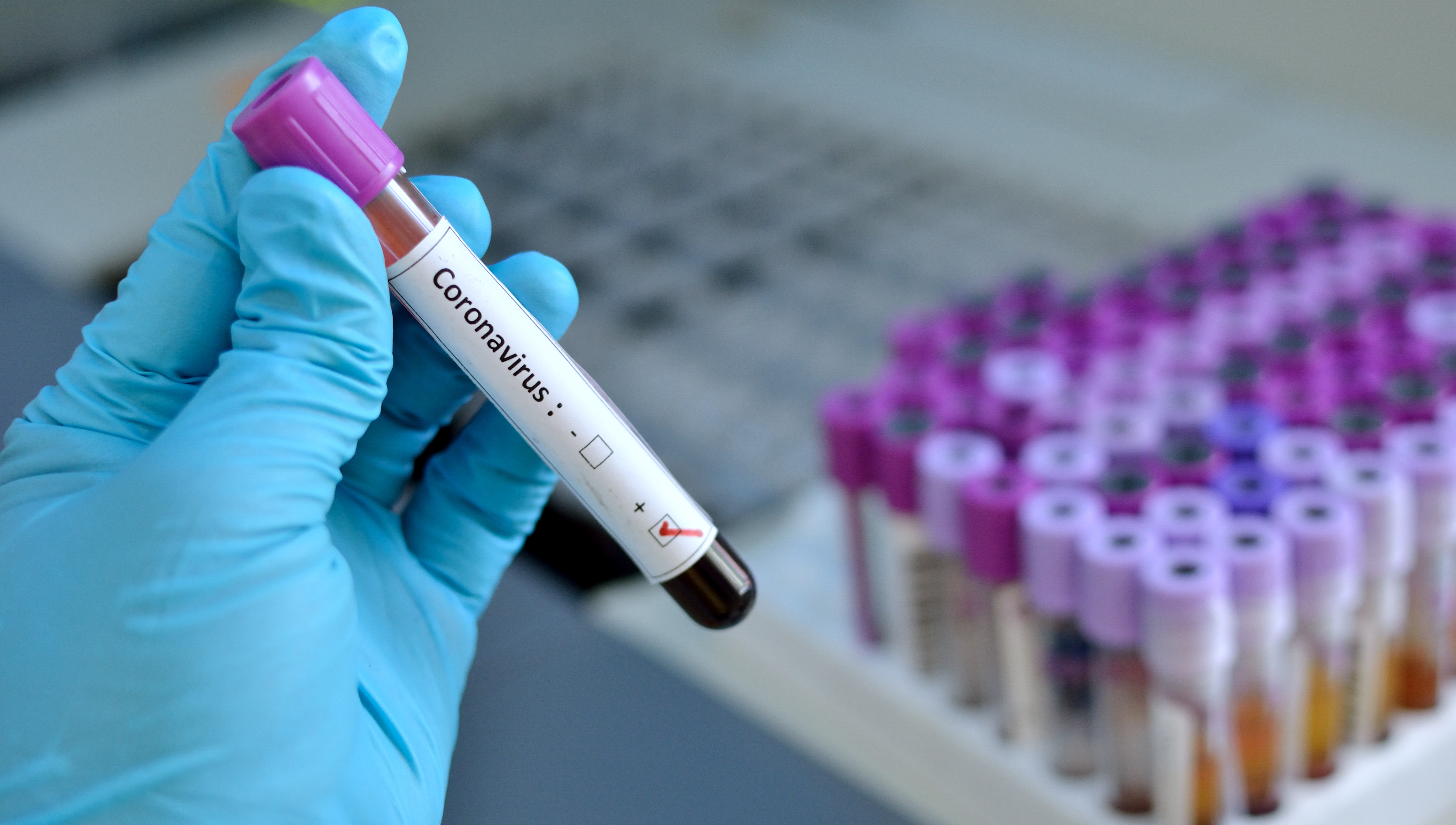 The new Wuhan coronavirus is a member of the coronavirus family that has never been encountered before. Like other coronaviruses, such as severe acute respiratory syndrome (Sars) and Middle Eastern respiratory syndrome (Mers) it has come from animals. Image: Getty Images Image:The new Wuhan coronavirus is a member of the coronavirus family that has never been encountered before. Like other coronaviruses, such as severe acute respiratory syndrome (Sars) and Middle Eastern respiratory syndrome (Mers) it has come from animals. Image: Getty Images